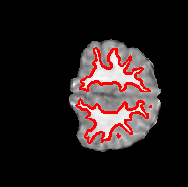 Figure 30